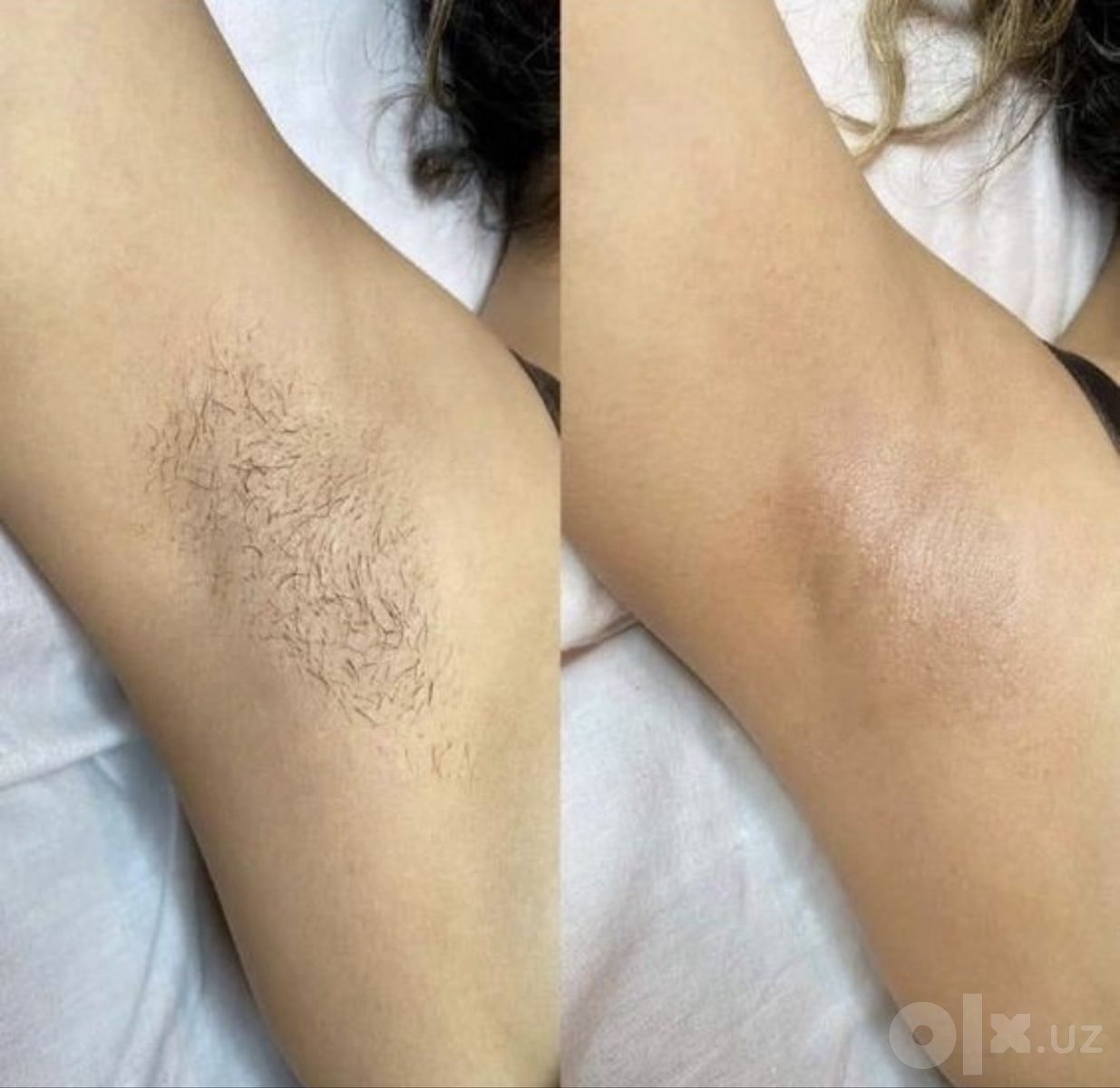 Шугаринг только для девушек, по записи