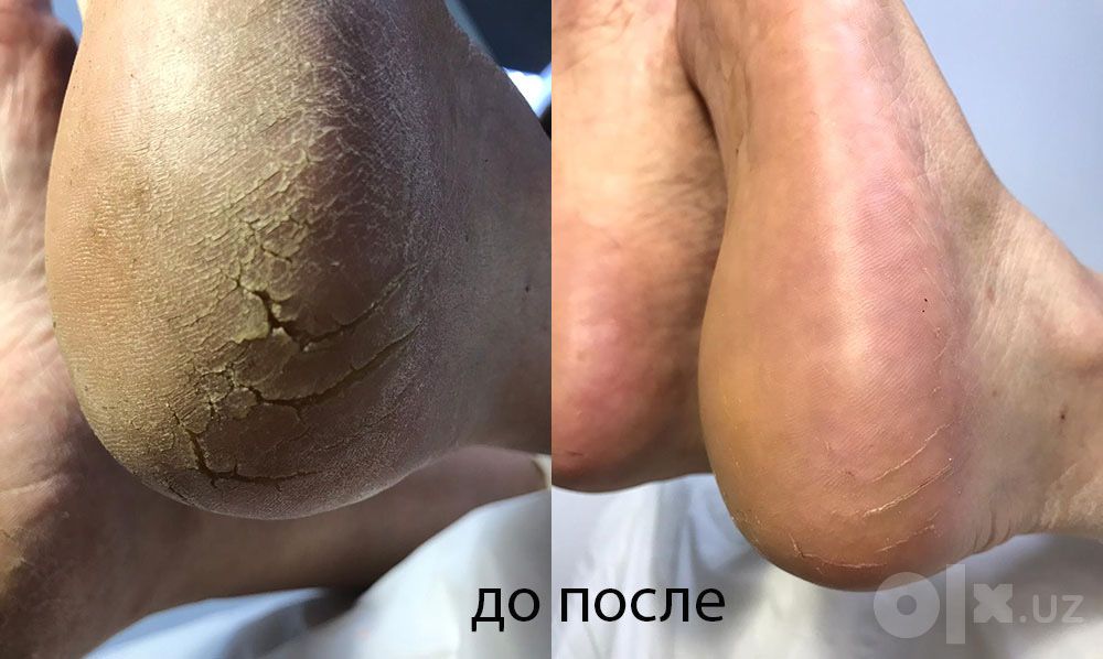 Маникюр и педикюр с выездом на дом по выходным